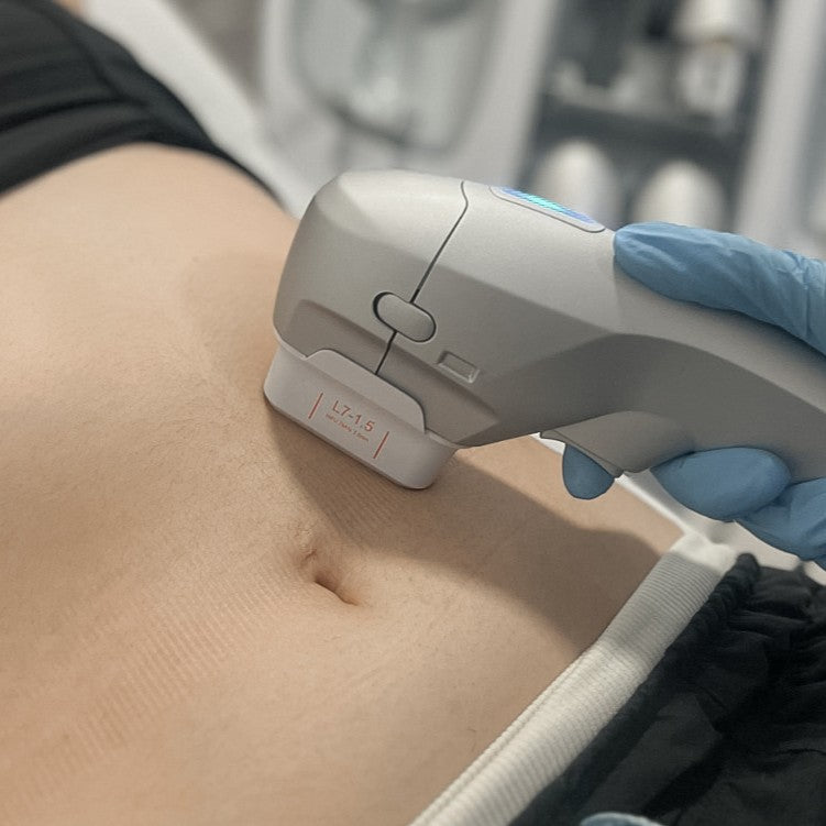 Ultraformer corporal