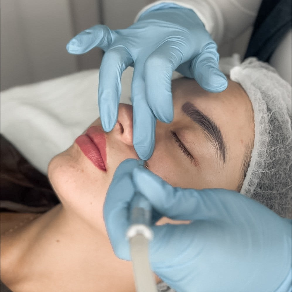 Microdermoabrasión