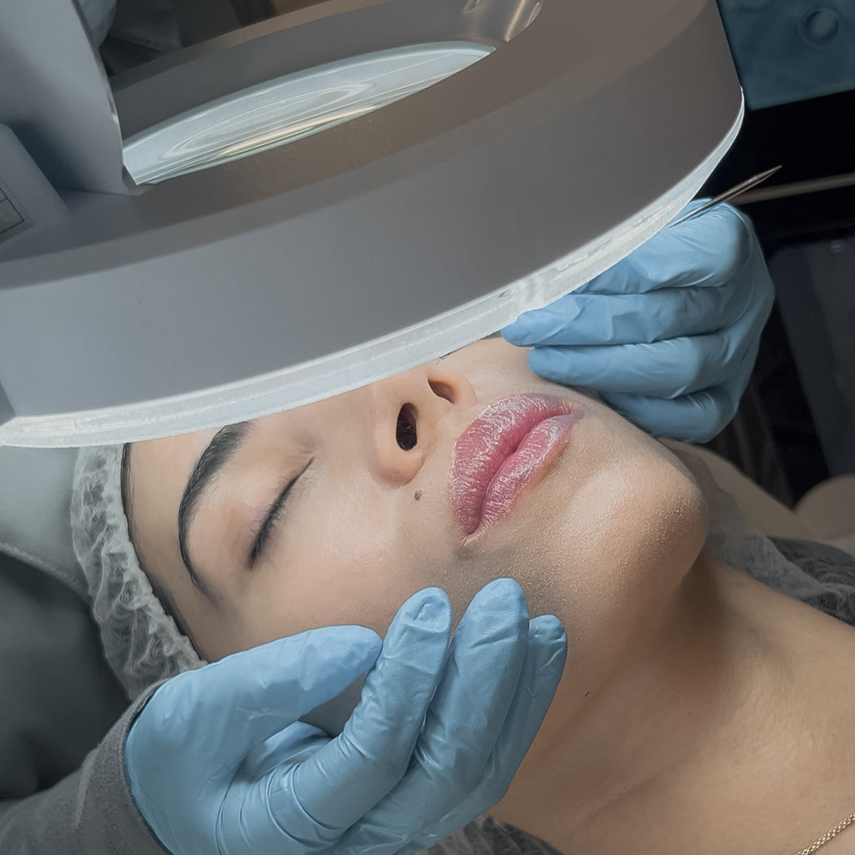 Tratamiento facial